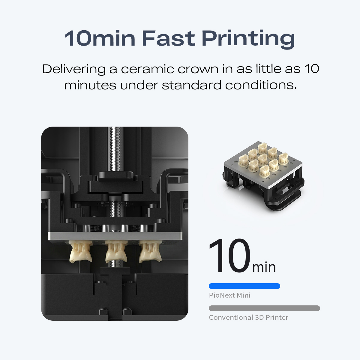 Mini High-precision Tandheelku - 3D Printing Orthodontics recensie en prijs