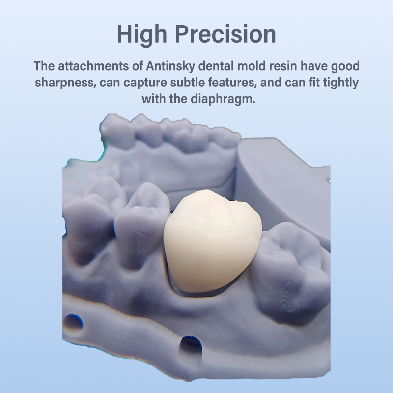 Antinsky Tijdelijke Tandheelku - 3D Printing Orthodontics recensie en prijs
